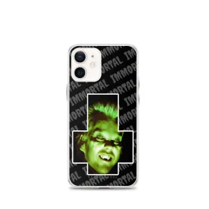 Inverted David iPhone Case